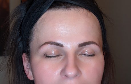 anti wrinkles treatment