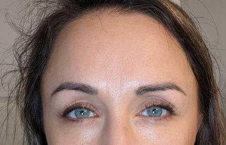 anti wrinkles treatment