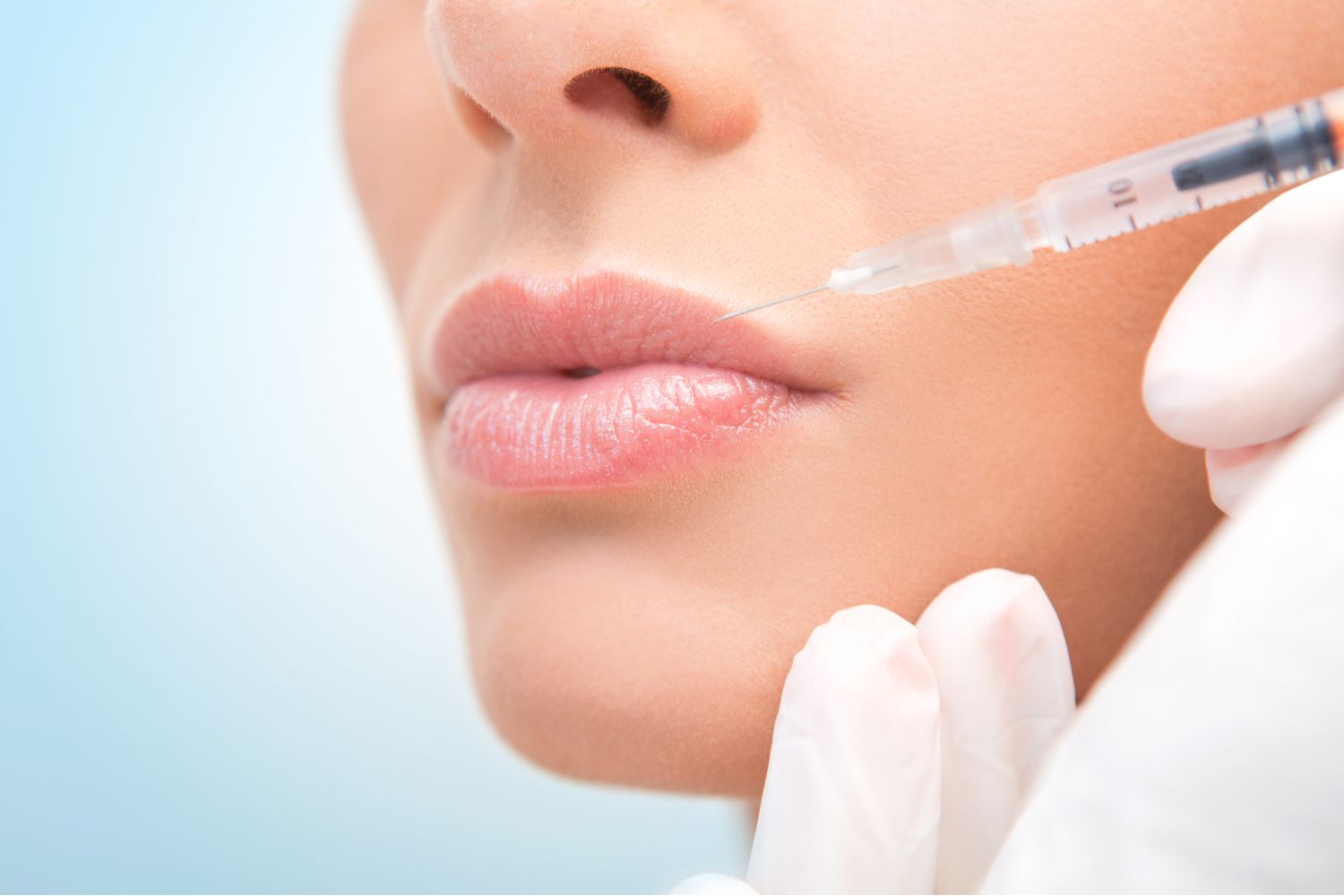dermal fillers post