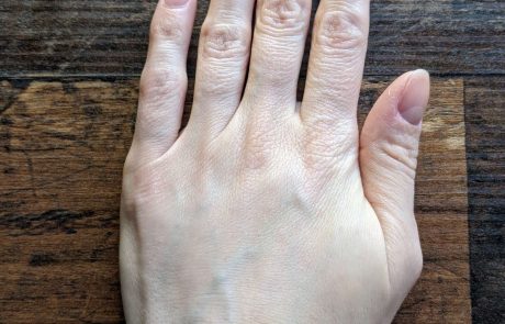 hands rejuvenation example