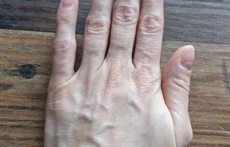 hands rejuvenation example