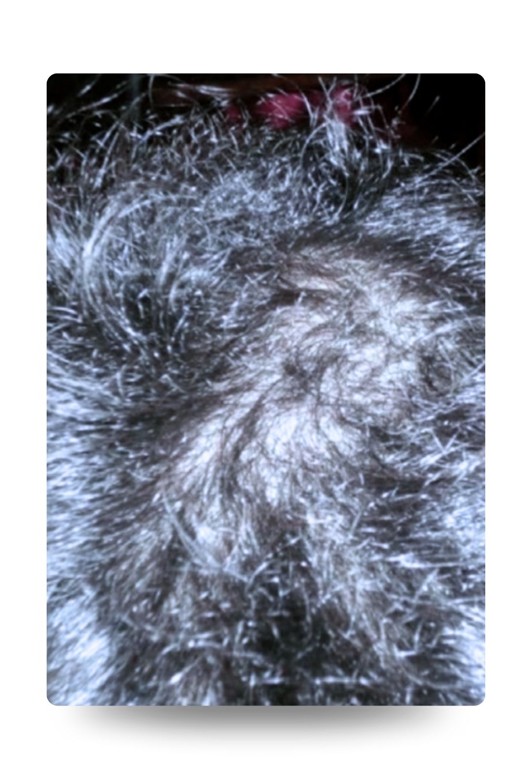 Polynucleotide hair treatment – after Polynucleotide hair treatment - after