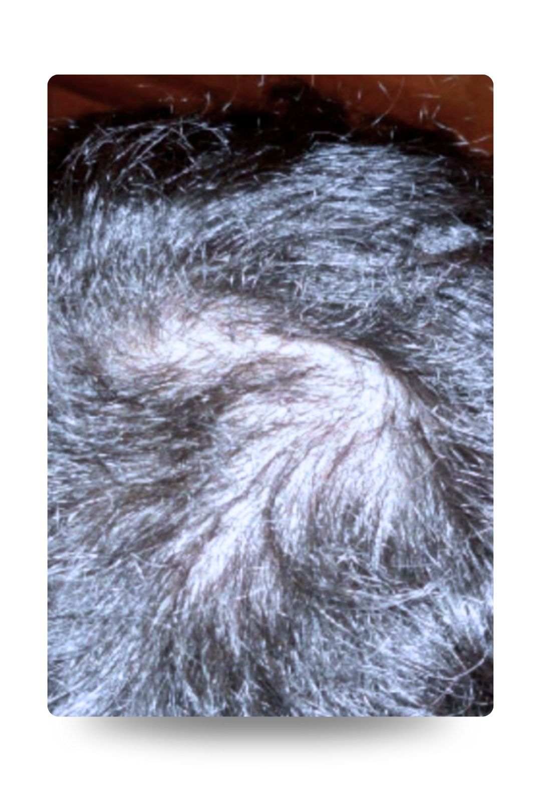 Polynucleotide hair treatment – before Polynucleotide hair treatment - before